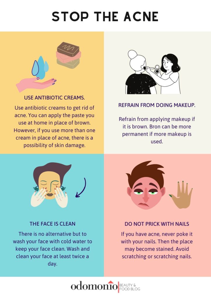 Avoid for acne